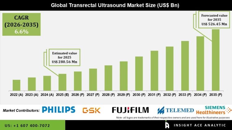 Transrectal Ultrasound Market Revenue Analysis and Growth Potential – Press Releases Distribution for Market Research Reports